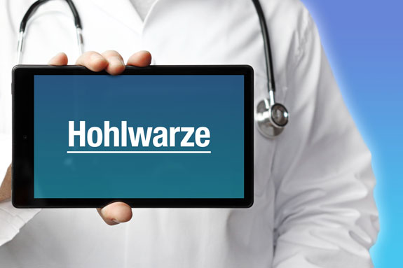 Schlupfwarzen Ingolstadt